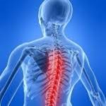 BEST Chiropractor on the Eastside | $250 for $50 Special Deal